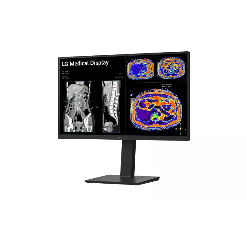 LG 27HS713C-B Computermonitor 68,6 cm (27 Zoll) 3840 x 2160 Pixel 4K Ultra HD LED Schwarz