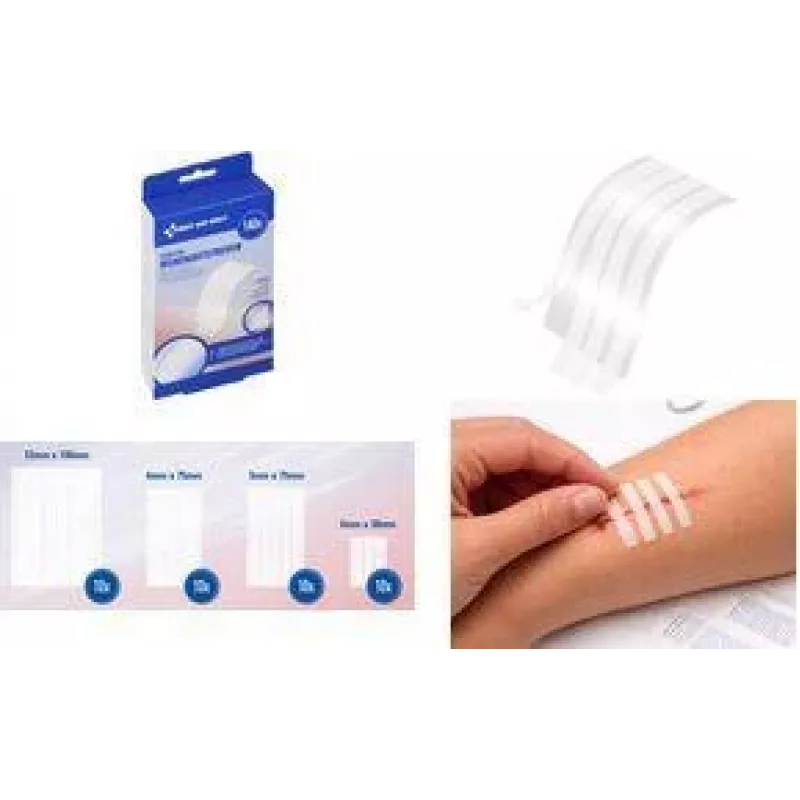 FIRST AID ONLY Sterile Wundverschlussstreifen, Weiß, 140 Streifen pro Blisterpackung (P-10095 00)