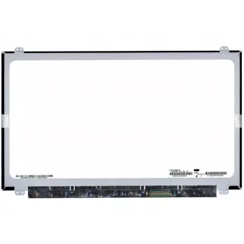LG 15,6 Zoll Full HD 1920x1080 60Hz Glänzend 40-Pin eDP IPS LED Laptop Bildschirmpanel - Rechter Anschluss